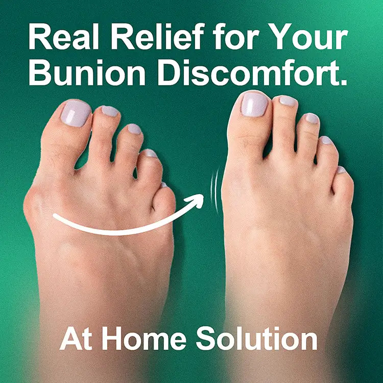 LOOOOMI™ BunionEase Pro